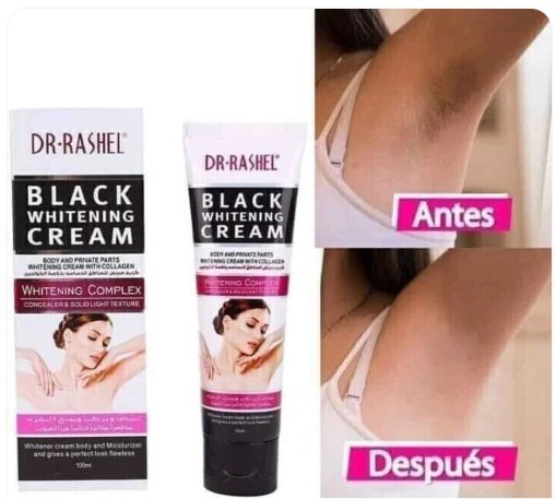 Crema Blanqueadora Corporal